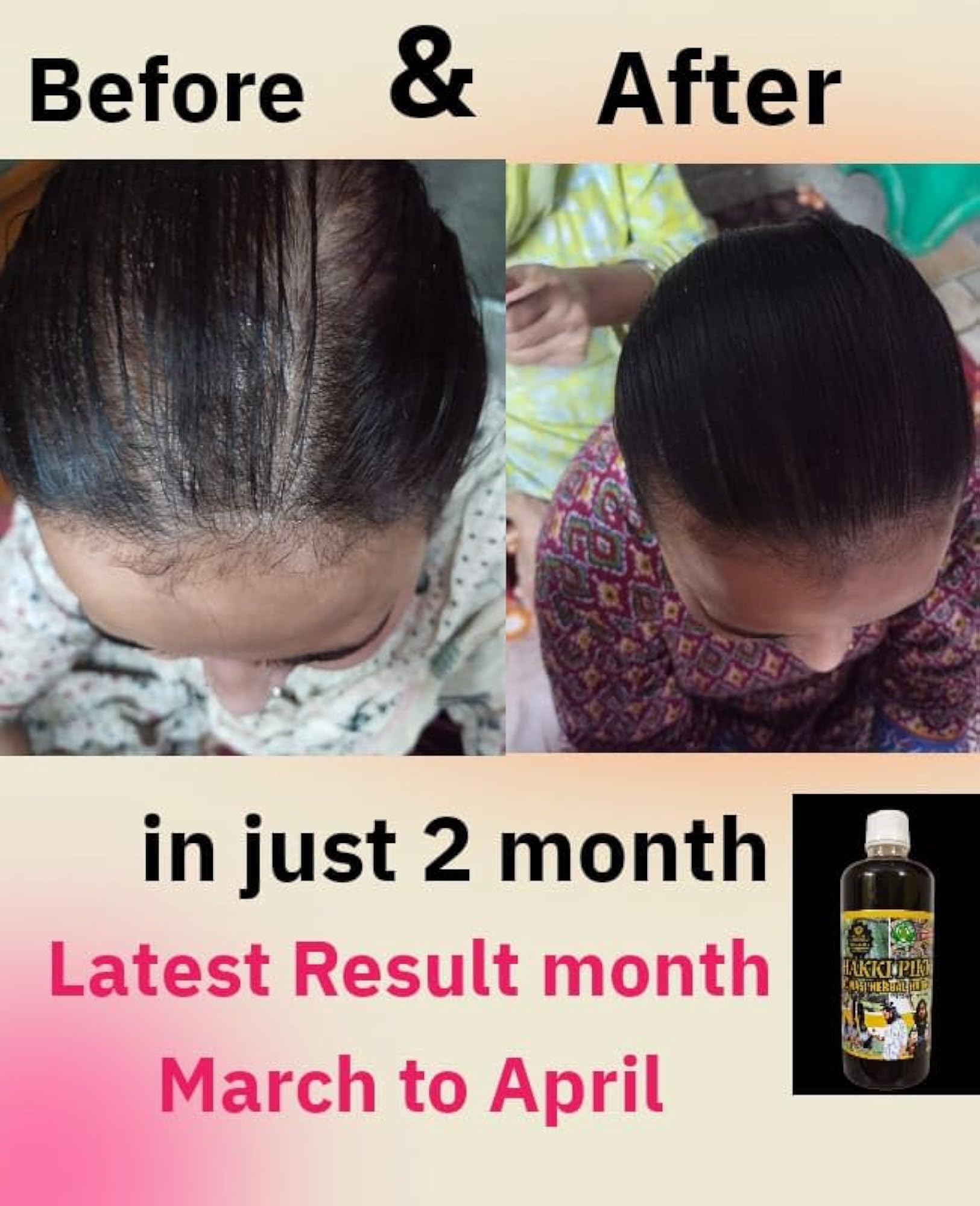 Karnataka Mysore Adivasi Herbal Hair Oil